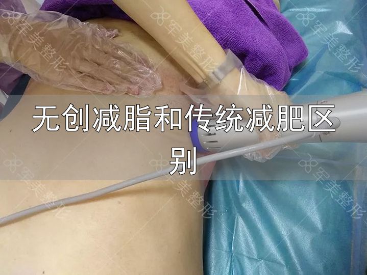 无创纤体瘦身 冷冻溶脂 体外冲击波_无创减脂和传统减肥区别
